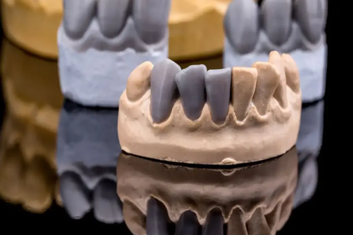 DiagnosticWaxUp-IMG2