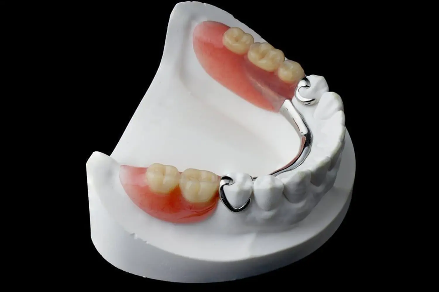 Partial-Dentures-2.jpg.optimal